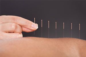 Acupuncture for Erectile Dysfunction